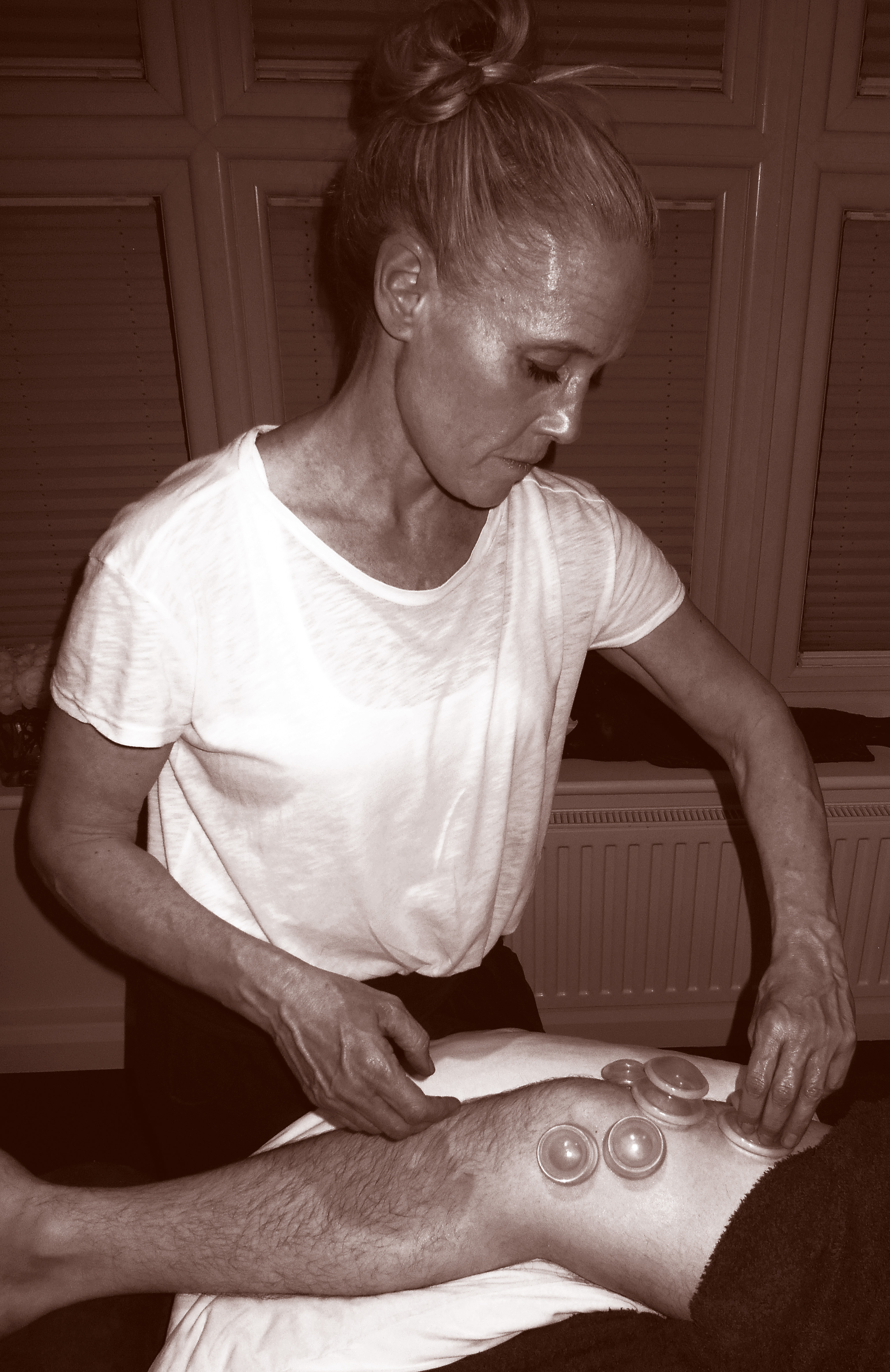 Cupping therapy treatment